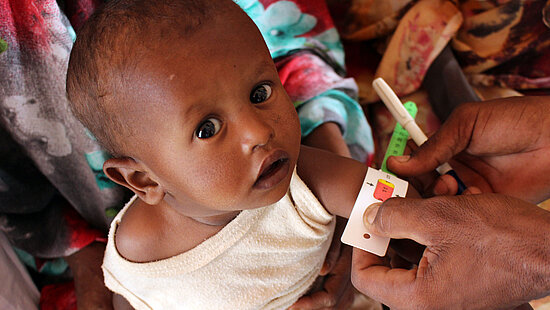 Bild: Baby Sham lässt seinen Armumfang bei einer mobilen Ernährungsberatung in einer Gesundheitsklinik in Sudan messen