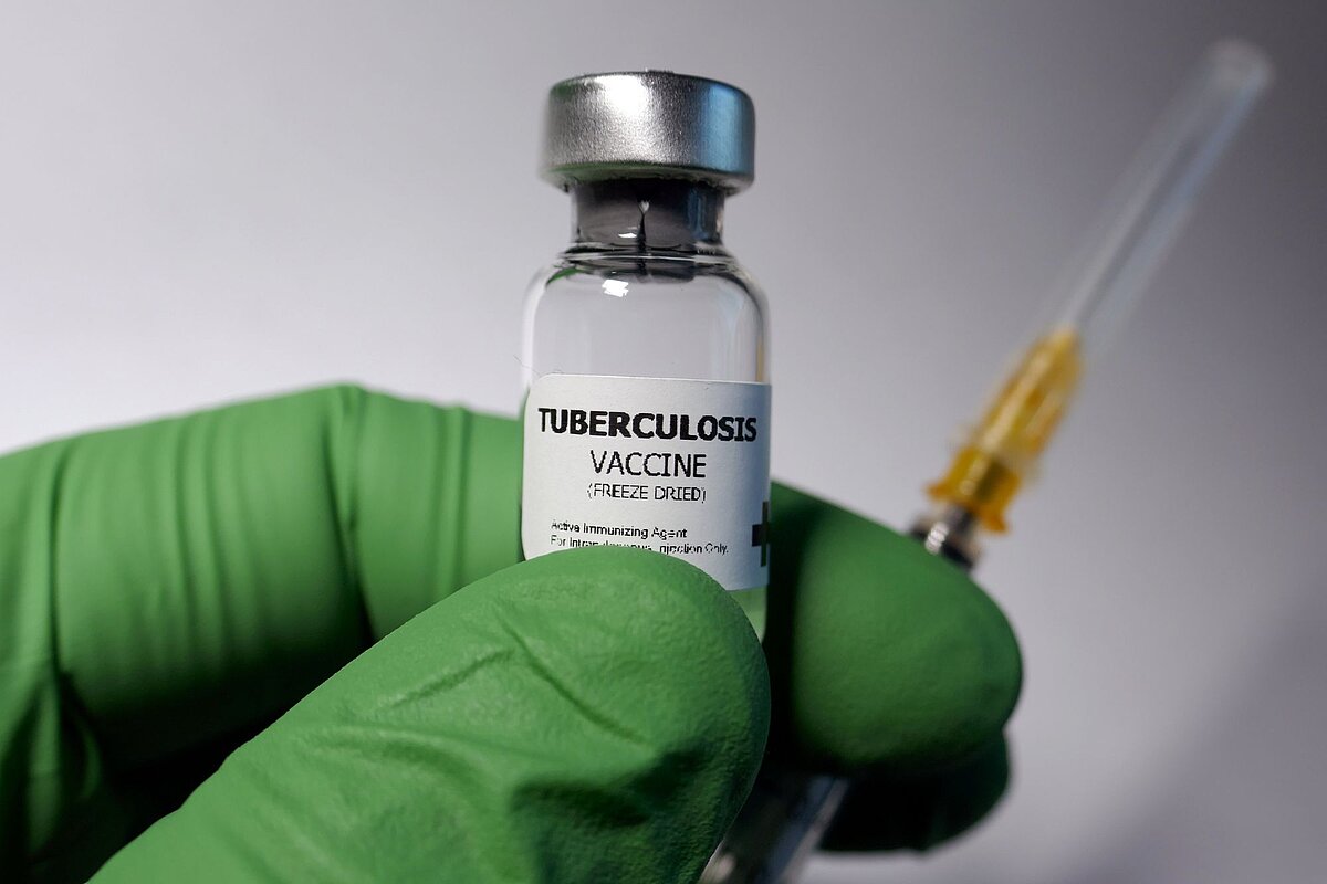 7 facts to know about tuberculosis