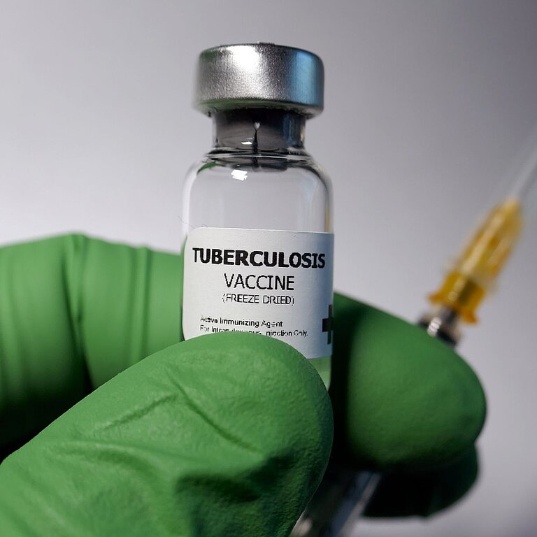 Eine Hand mit Einmalhandschuh hält eine Ampulle mit Impfstoff für Tuberkulose