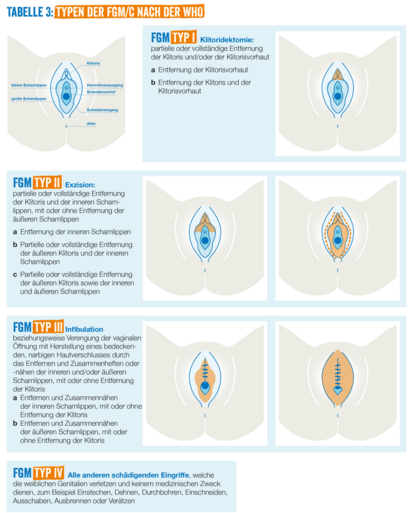 Übersicht FGM-Typen