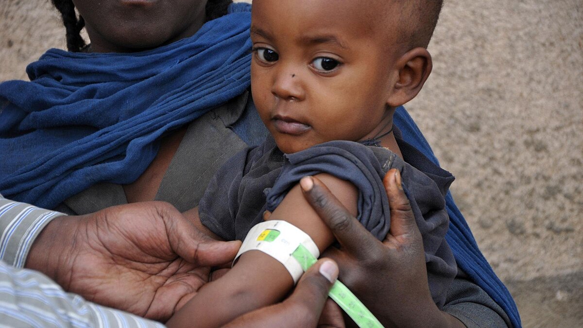 Hunderttausenden Kindern in Äthiopien droht der Hungertod | Plan ...